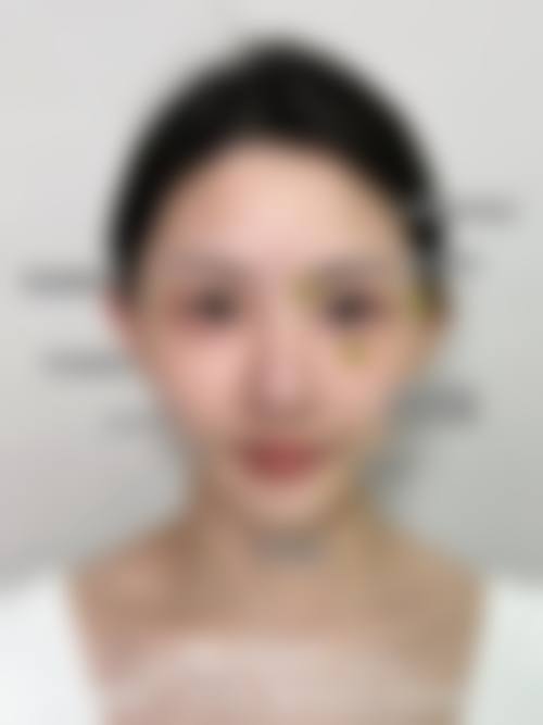 梅明医生的成功实例