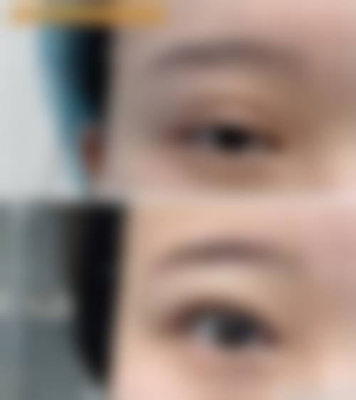 韩国来丽（laree）整形医院怎么样来院路线