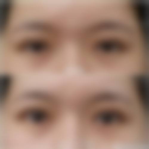 韩国来丽（laree）整形医院怎么样价格收费