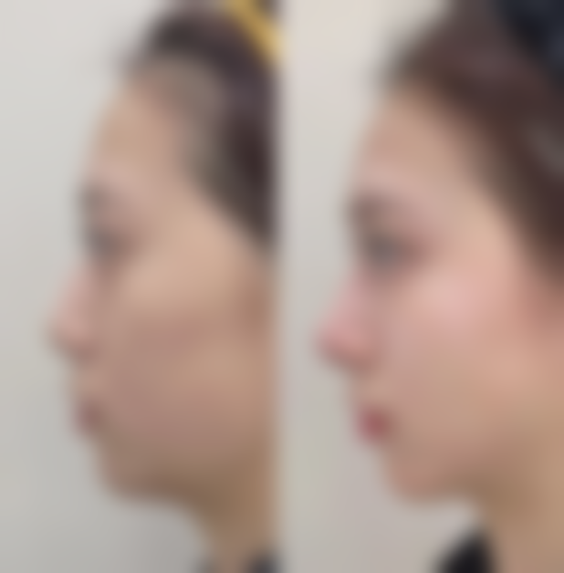 广西百色焱美医疗美容门诊部怎么样来院路线