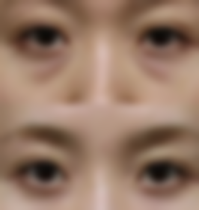 梅明医生的凯婷微创美容特色