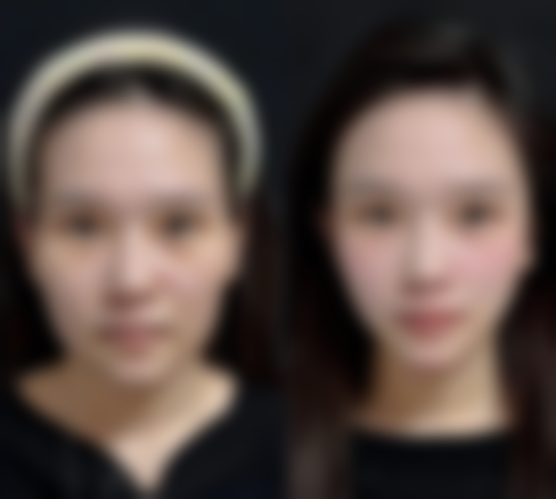 广州美妍整形怎么样求美者反馈