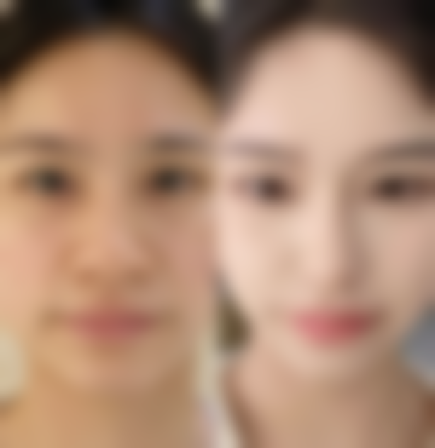 成都高新玉嫱医疗美容诊所怎么样求美者反馈