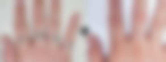 韩国科琳挞图皮肤洗纹身医院怎么样简介概述