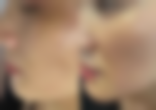 宁波市中医院(医疗美容)怎么样价格收费