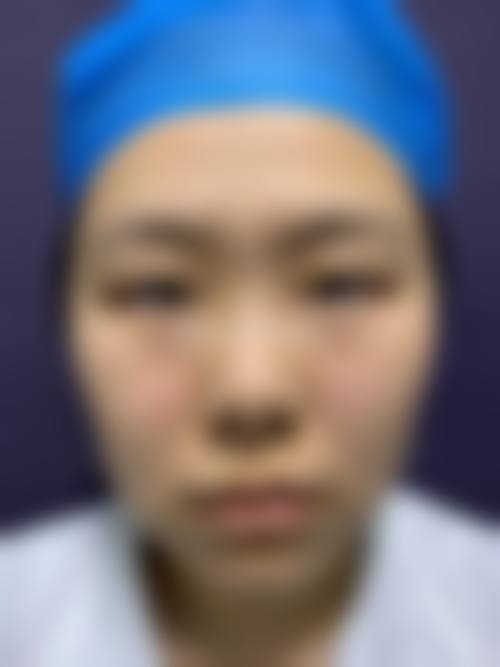 韩国JAEESIA整形外科怎么样求美者反馈