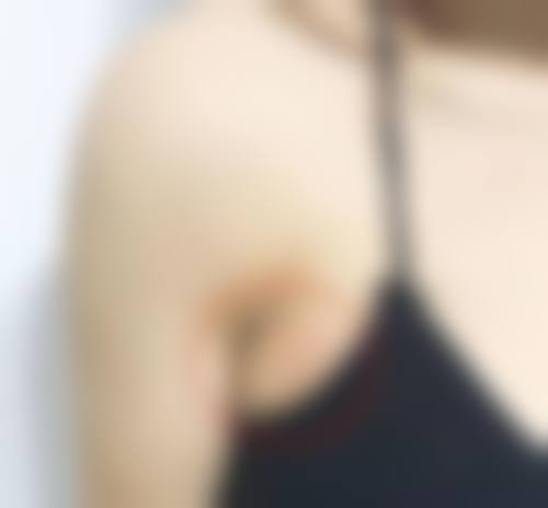 大连医 科 大学附属第二医院整形外科怎么样价格收费