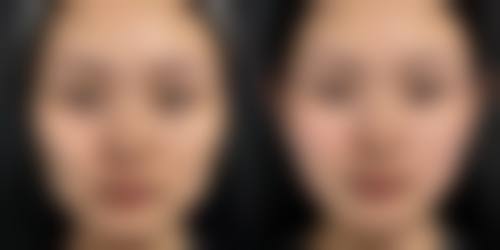 安徽合肥芬格嘉美整形诊所怎么样特色项目及技术优势