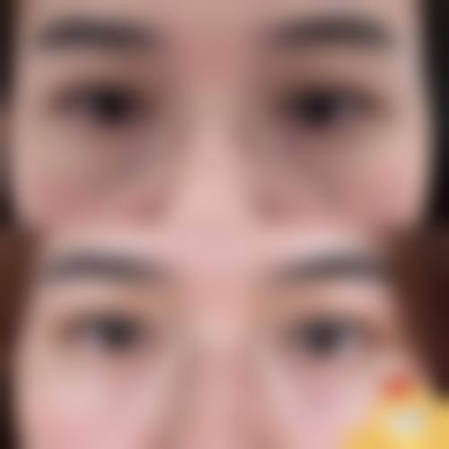 安晶玉擅长的热门医美项目