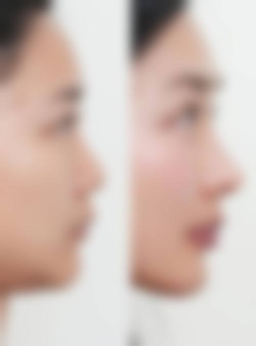 吴宰元医生的出色技术成就