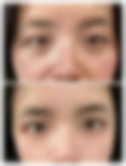 安晶玉助力的成功变得更美实例