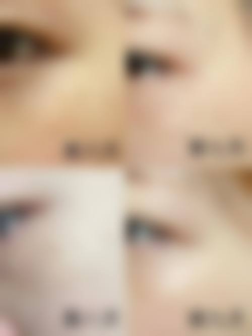 Belle美容外科 大阪院怎么样求美者反馈