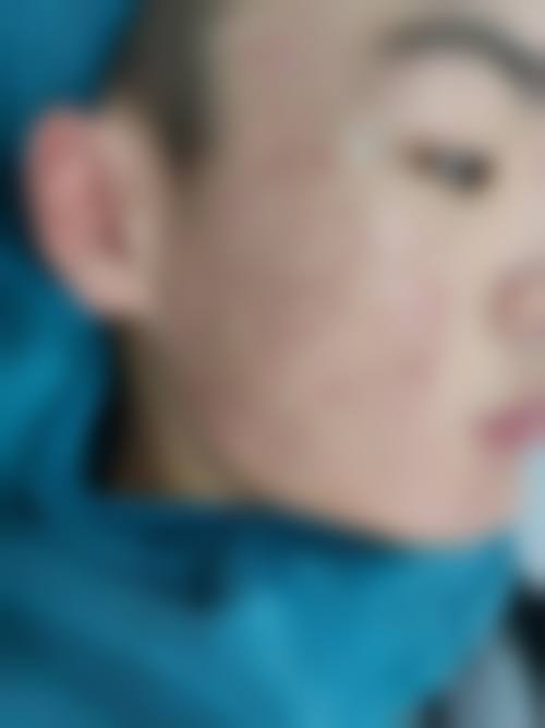 南宁肤康皮肤医院怎么样求美者反馈