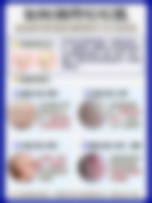 南宁肤康皮肤医院怎么样价格收费