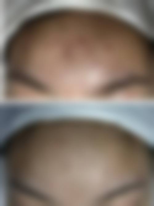 南宁肤康皮肤医院怎么样特色项目及技术优势