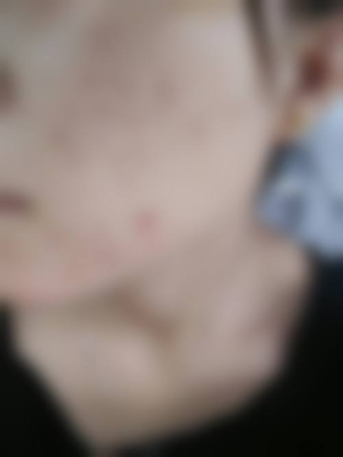 南宁肤康皮肤医院怎么样基本信息