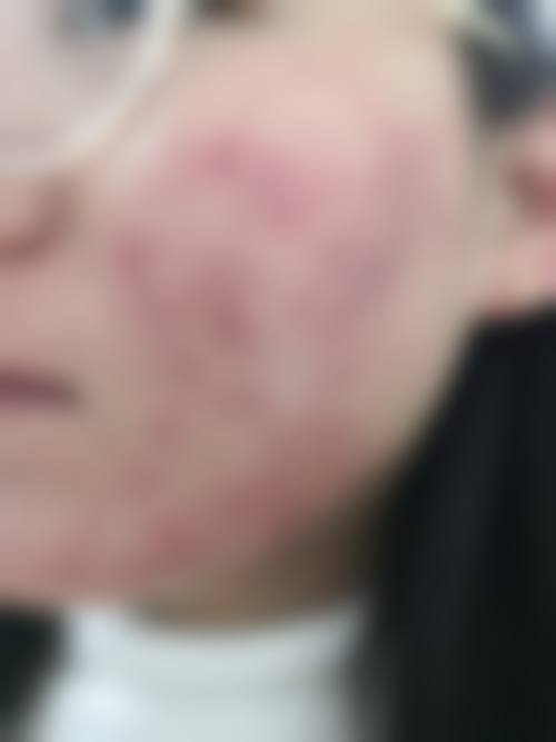 南宁肤康皮肤医院怎么样医生团队实力