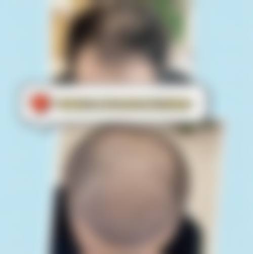 宁波市中医院(医疗美容)怎么样医生团队实力