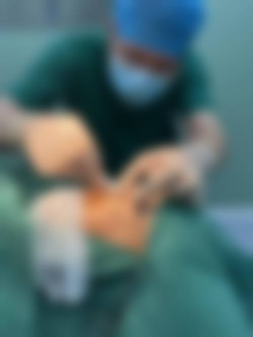 陈德洲医生的技术特色