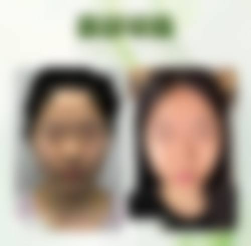 昆明德尔美客整形美容医院怎么样价格收费