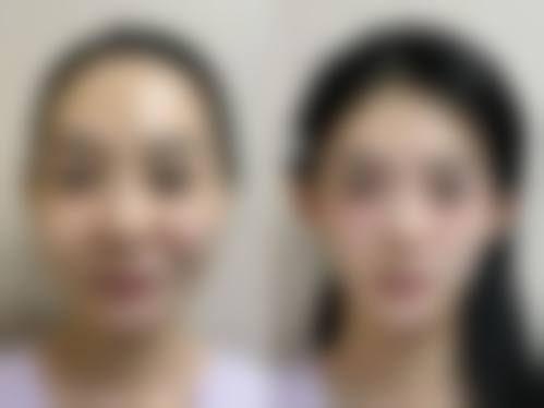 大连医 科 大学附属第二医院整形外科怎么样来院路线