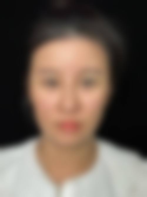 祁童医生负责的医美价格