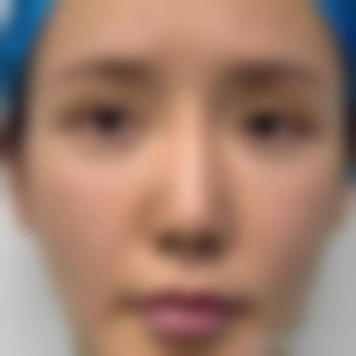 祁童医生的特色技术优势