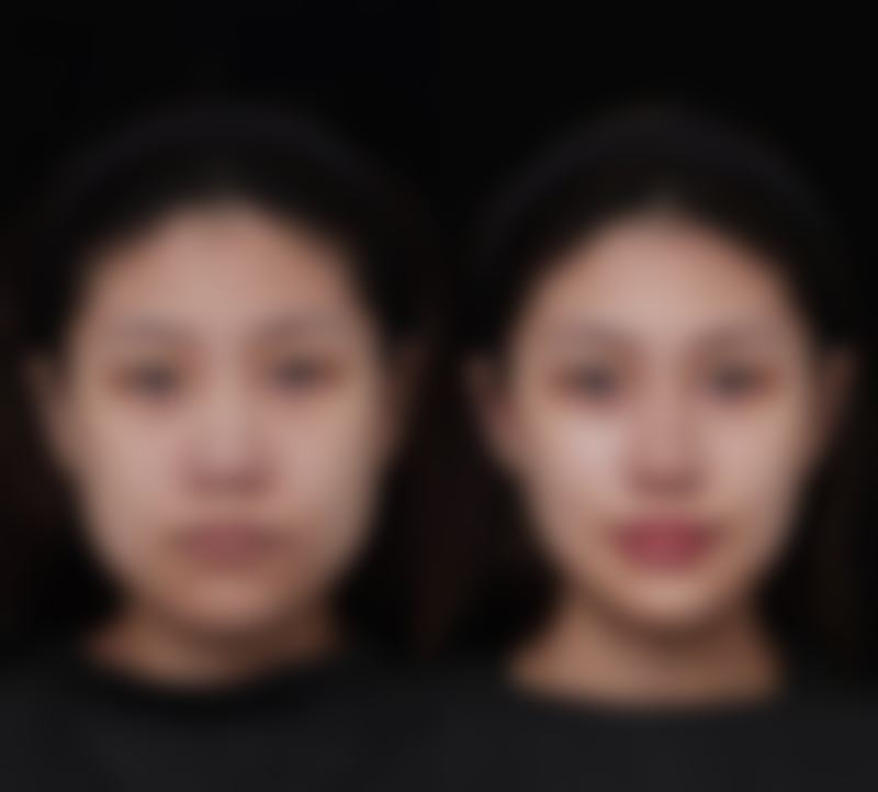 南昌曦之萌整形医院怎么样医生团队实力