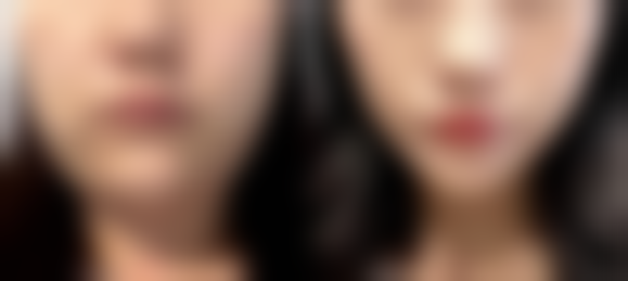 李金成医生的擅长领域