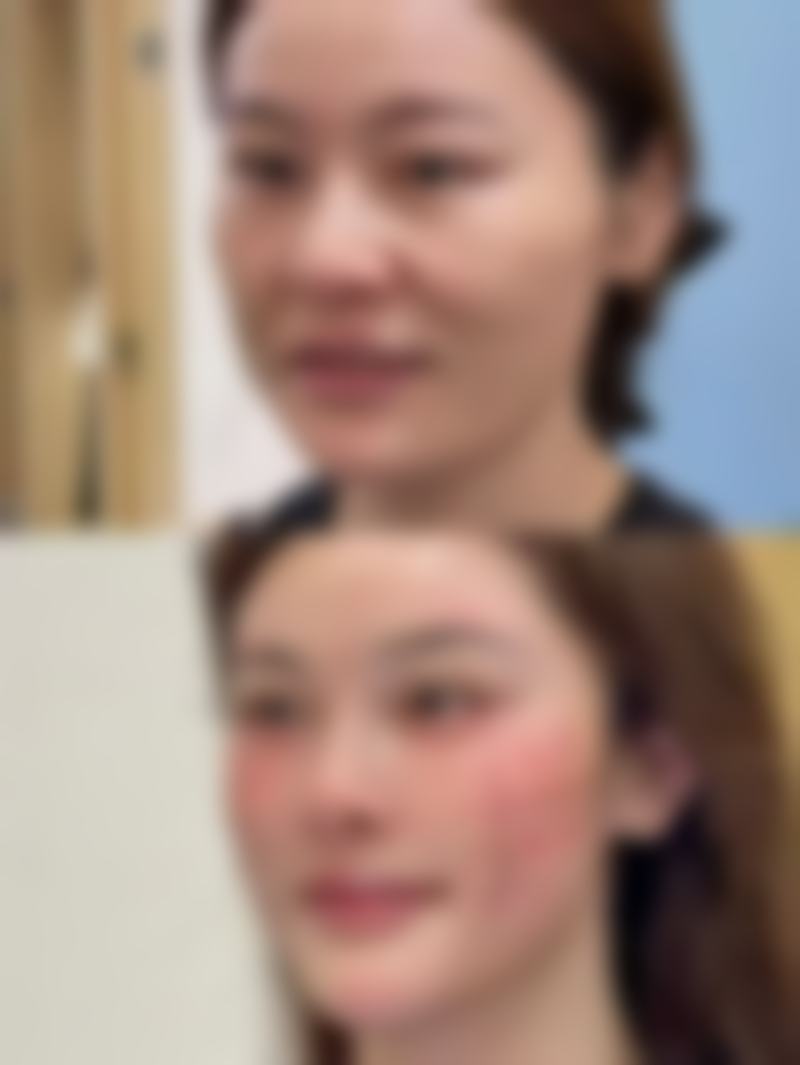 安徽合肥芬格嘉美整形诊所怎么样求美者反馈