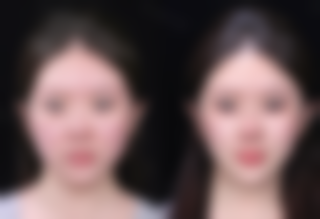 李金成医生的价格优势