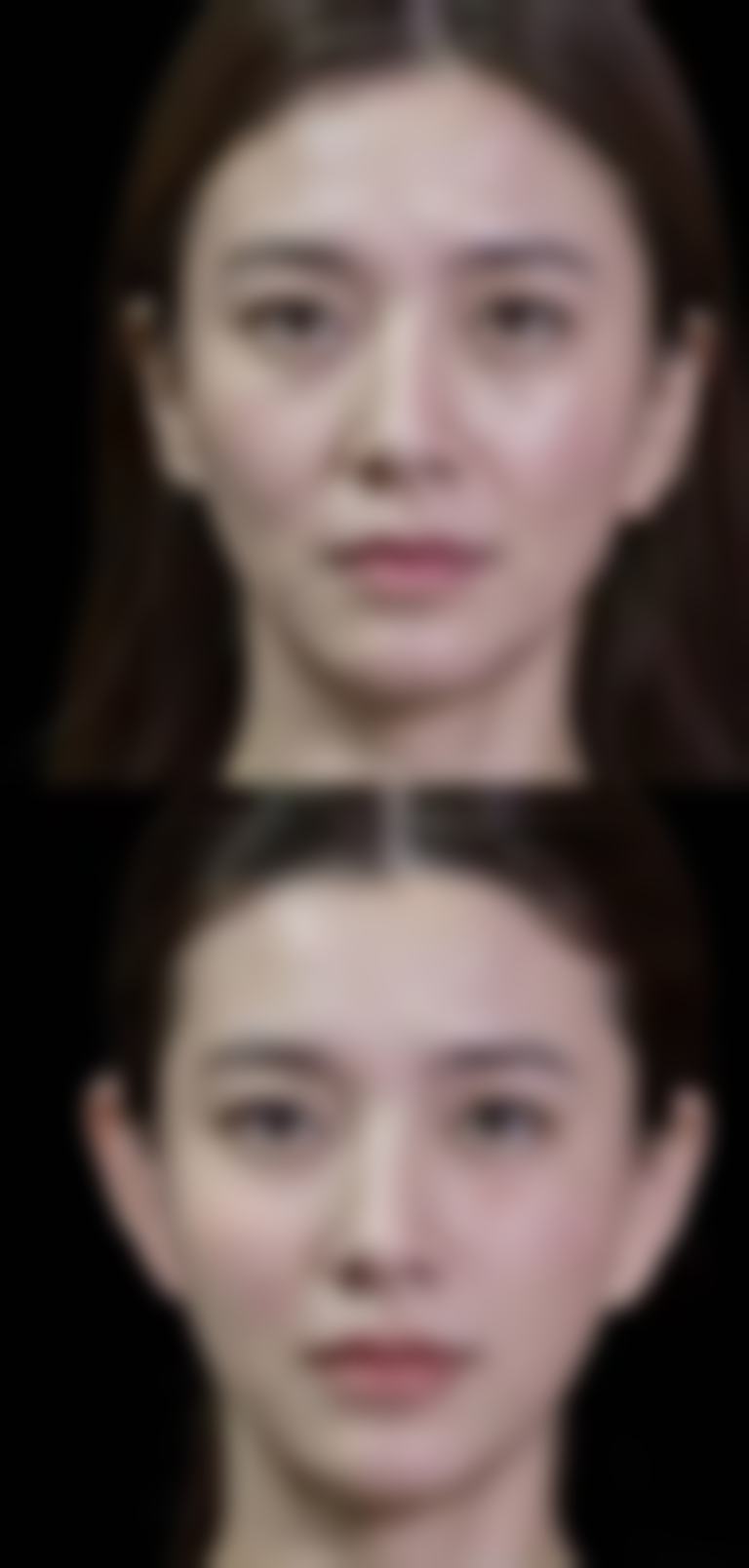 梅明医生的成功实例展示