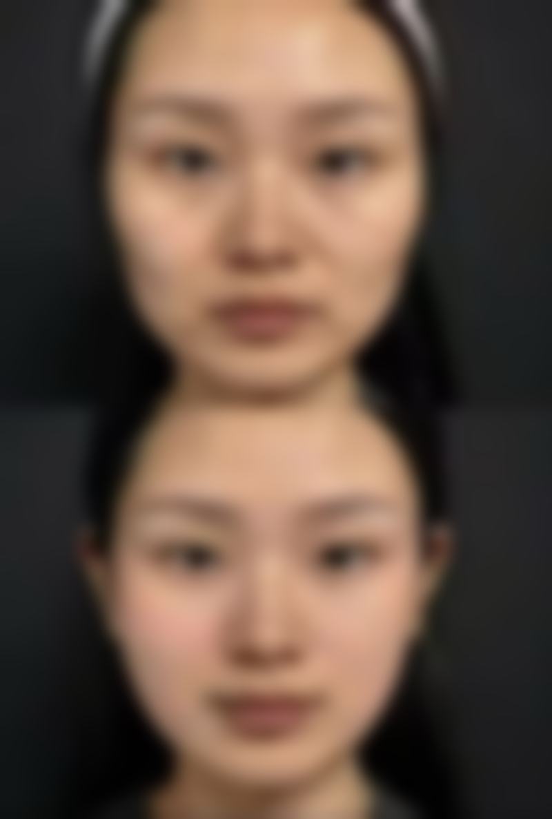 南昌曦之萌整形医院怎么样价格收费