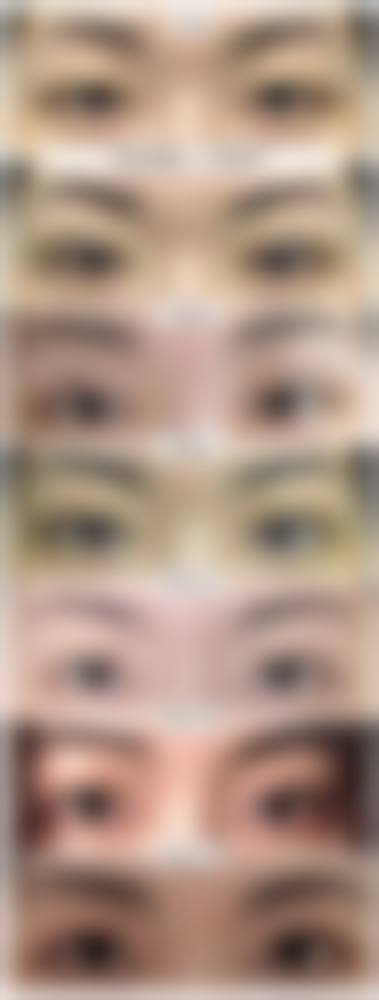 西安亚美医疗美容怎么样来院路线