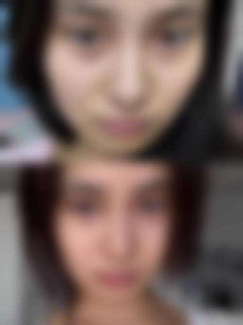 潘敏医生擅长的医美项目及价格