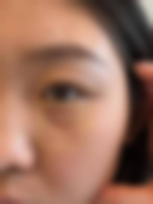 陈瑞阳融合精良技术打造个性化方案