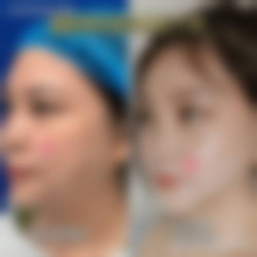 祁童医生的热门项目价格