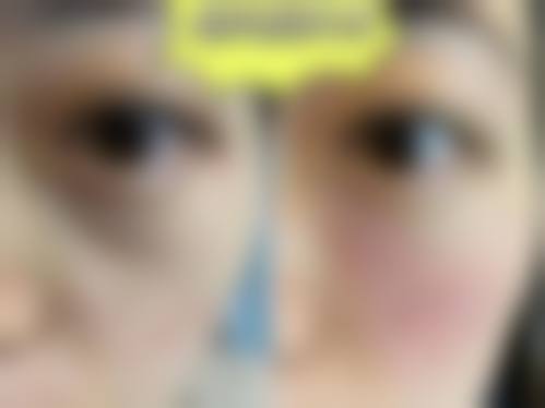 选择潘敏医生的理由