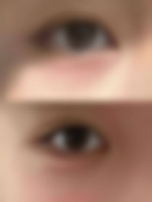 安晶玉医生的特色整形技术