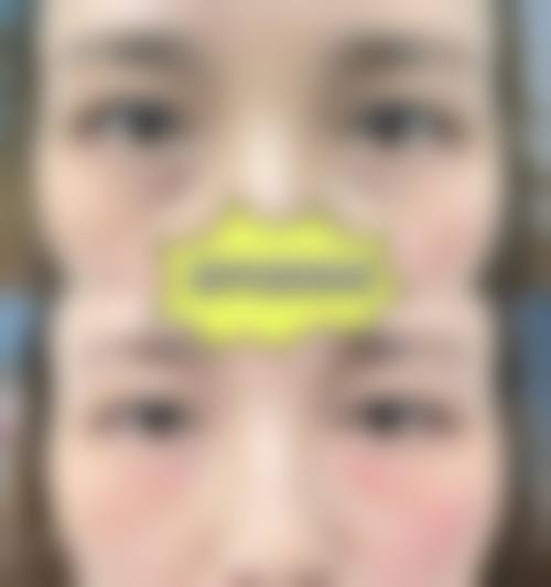 选择安晶玉医生的理由