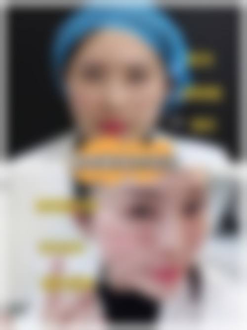 祁童医生助力您开启美丽之旅