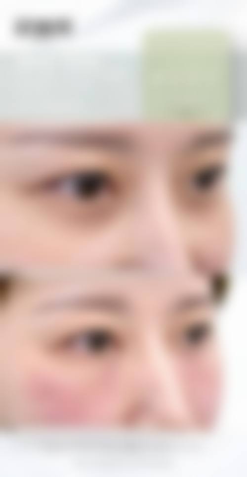 潘敏医生助力您的美丽蜕变