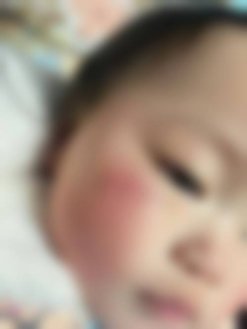 吴宰元医生的患者口碑