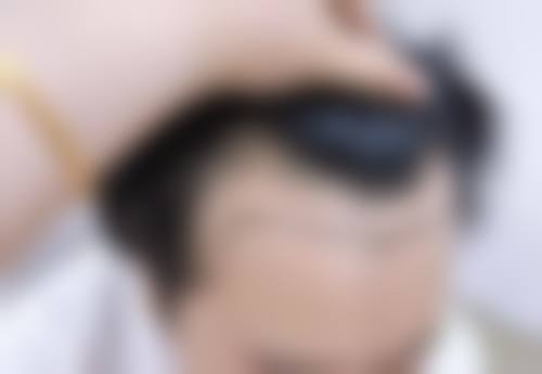 吴宰元医生的技术特色