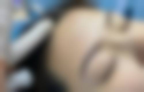 襄阳禾丽白月光整形医院怎么样价格收费