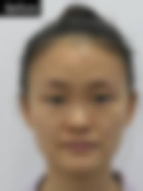 佛山壹加壹玛丽娅整形美容医院怎么样求美者反馈