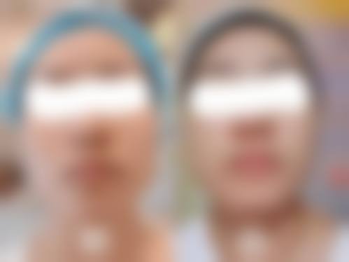 南京万艾特整形医院怎么样求美者反馈