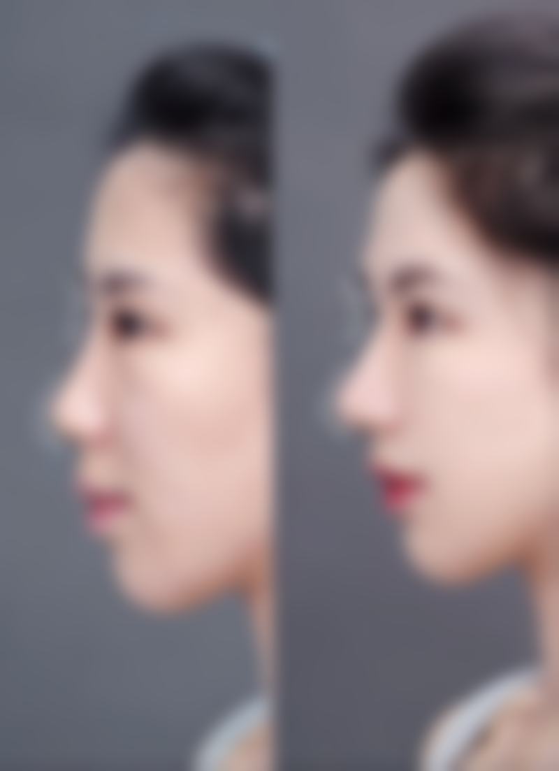 蒋思聪医生的医美项目价格优势