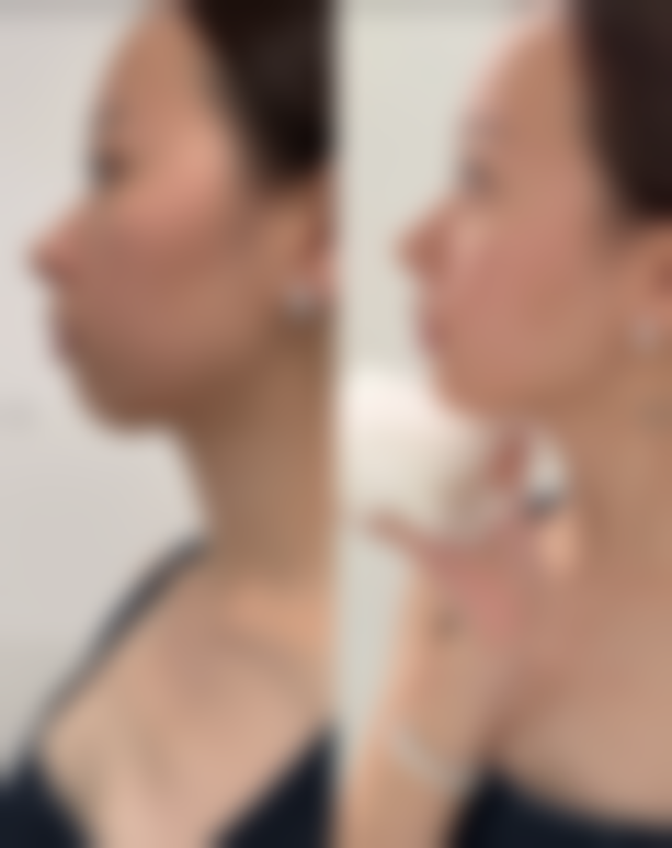 朴胜波医生的整形技术优势