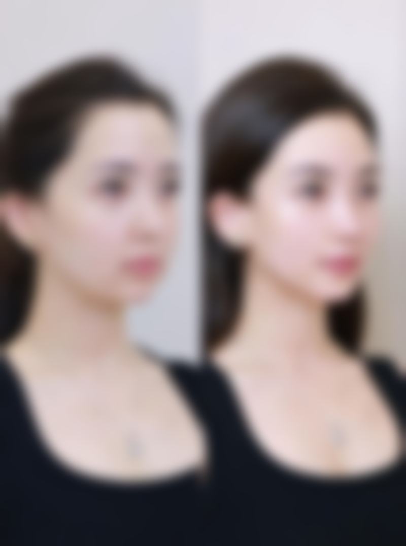 蒋思聪医生的专精医美团队协作